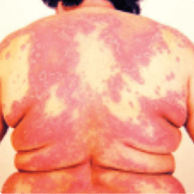 (C) Caractéristiques macroscopiques du PPG.